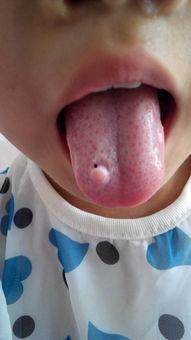 吃小白瓜舌头难受,小白瓜引发的不适体验